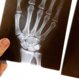 Röntgenbild Hand